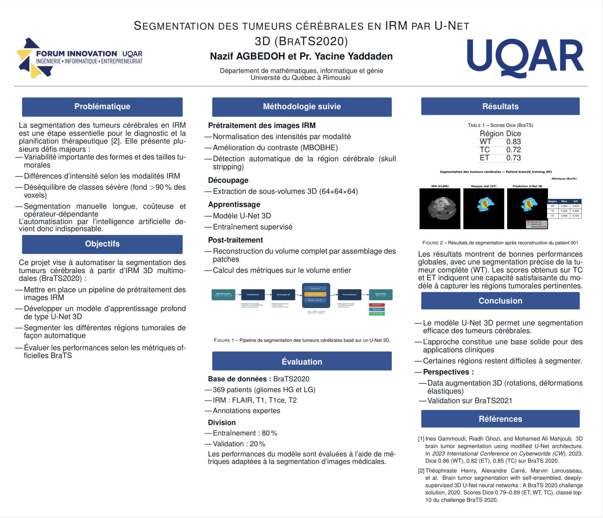 Segmentation des tumeurs cérébrales en IRM par U-Net 3D (BraTS2020)